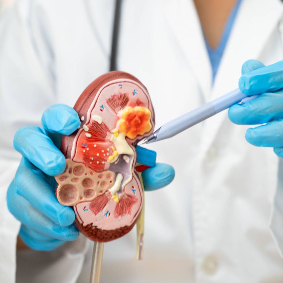 memahami laju filtrasi (DFG)